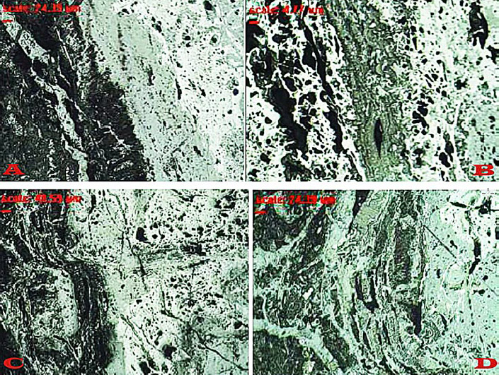 Figura 5. A) Vista longitudinal 100X (con nital al 3%); B) Vista longitudinal 100X (sin nital); C) Vista transversal 50X (con nital al 3%); D) Vista transversal 100X (con nital al 3%)